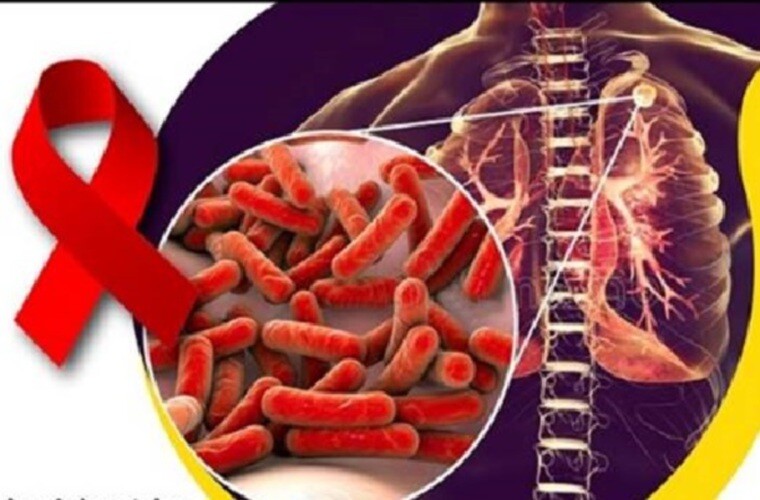 Panama Carnival: Free HIV and STI Testing