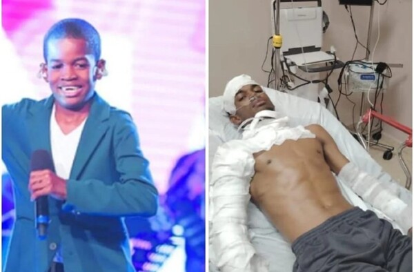 'Pelao Con Salsa' Winner Suffers Burns, Alleges Delay in Care