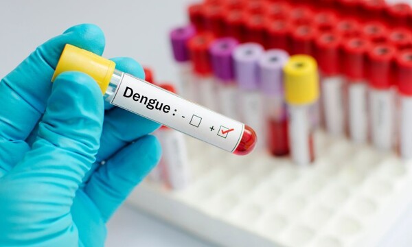 Panama dengue cases down